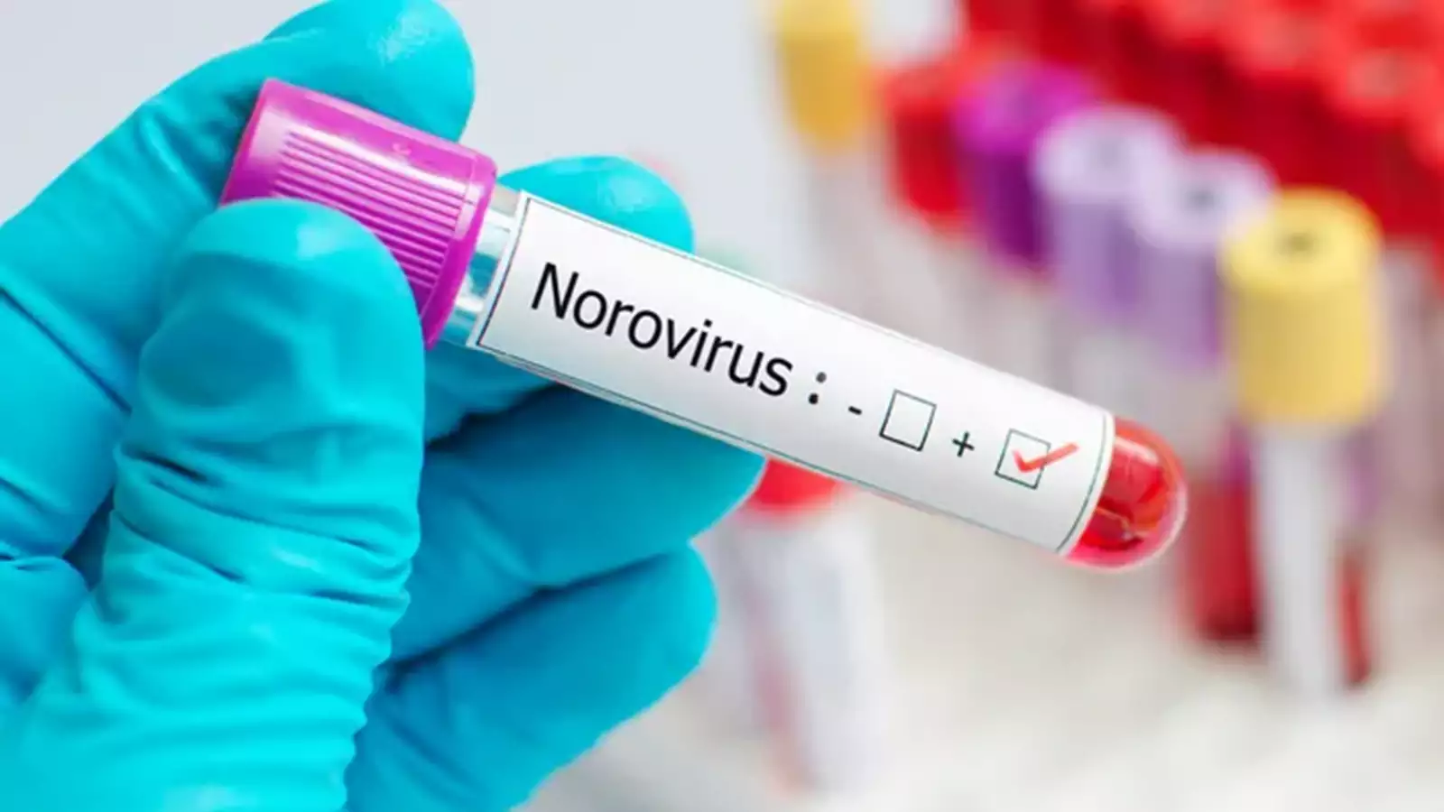 Norovirus