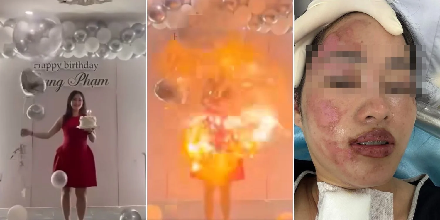 Hydrogen Balloon Explodes on Woman’s Face While Posing with Birthday Cake in Vietnam: Watch