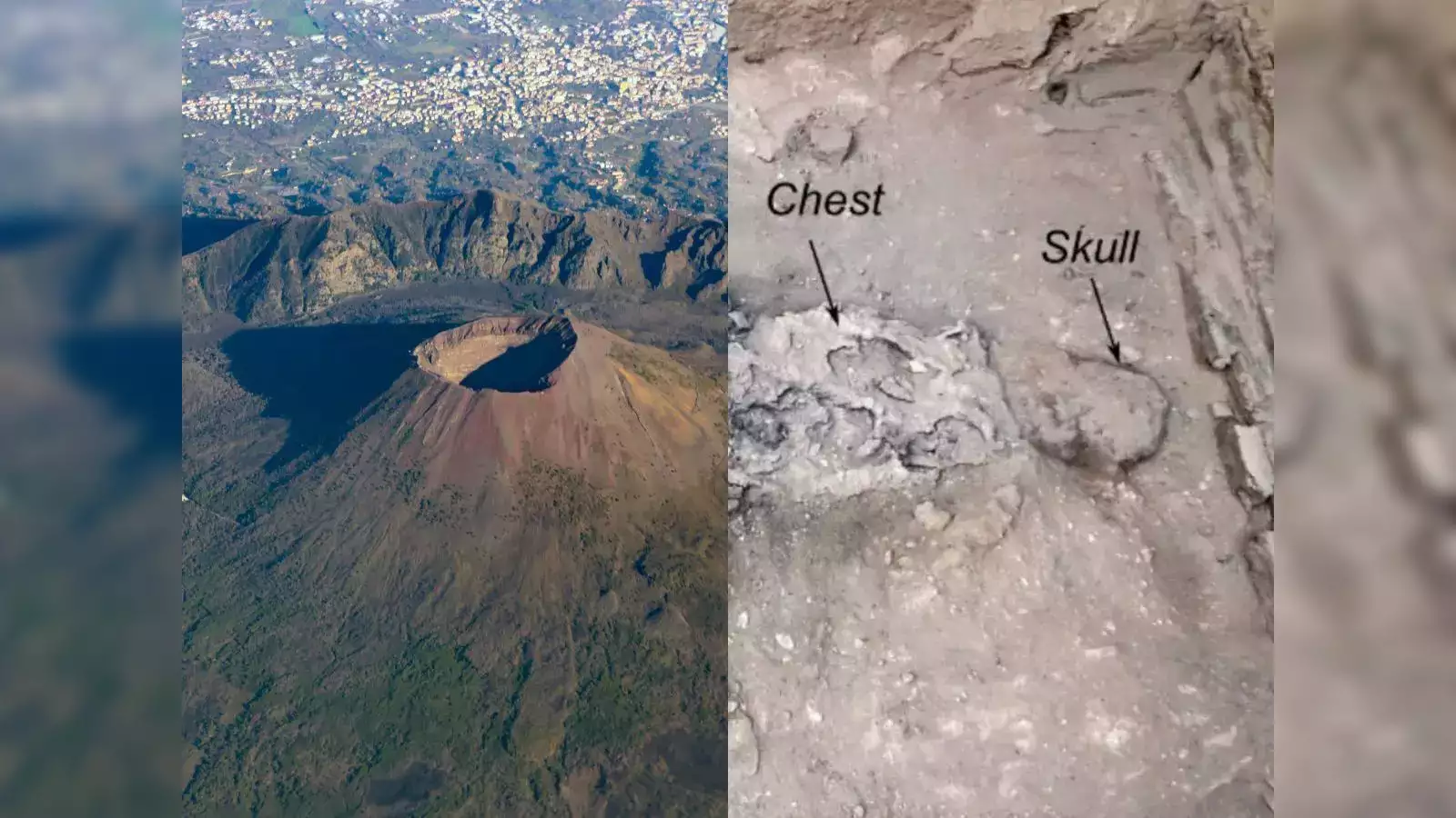 Brain Turned to Glass