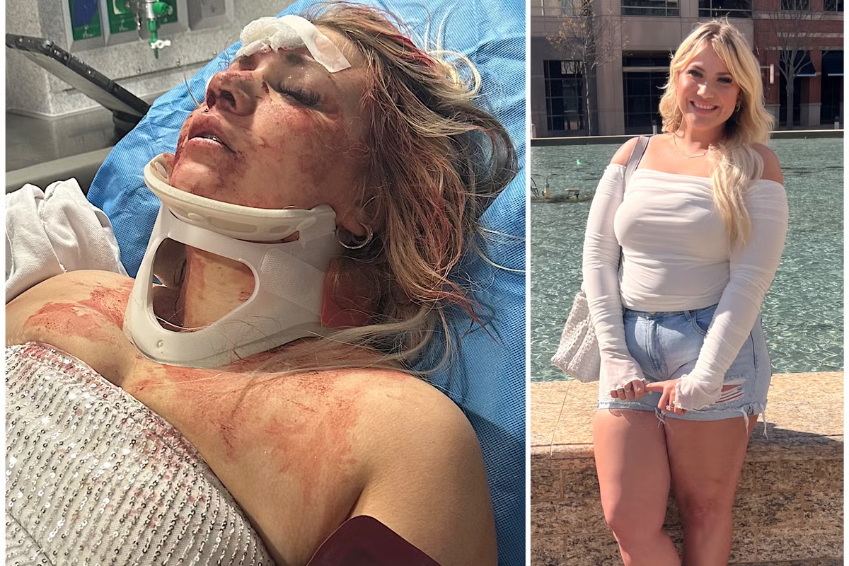 bride-to-be viciously attacked by stranger