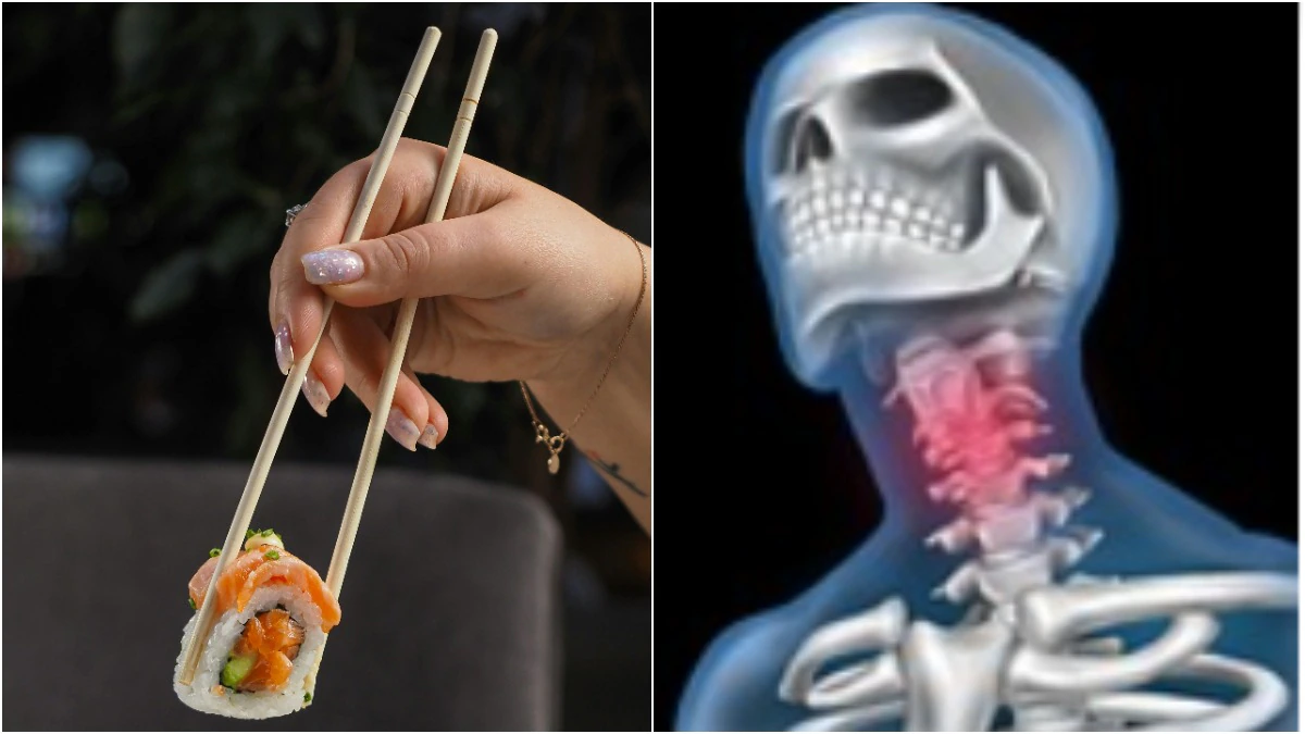 Chopstick Lodged in Throat